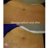 Allura Skin and Laser Centre image 6
